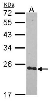 Western Blot: CRIP2 Antibody [NBP2-16011]