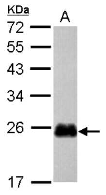 Western Blot: CRIP2 Antibody [NBP2-16012]