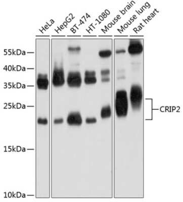 Western Blot: CRIP2 AntibodyBSA Free [NBP2-92574]