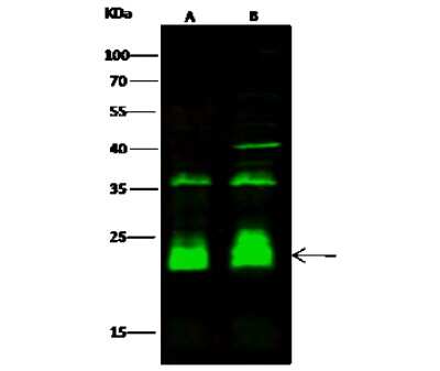 Western Blot: CRIP2 Antibody [NBP3-00315]