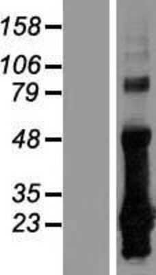 Western Blot: CRIP2 Overexpression Lysate [NBL1-09478]