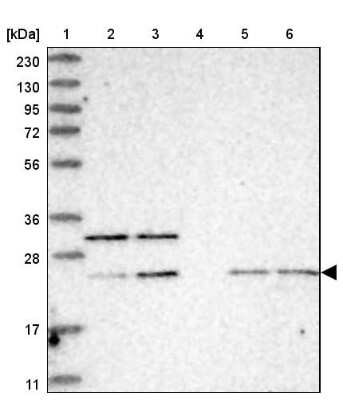 Western Blot: CRIP3 Antibody [NBP1-88762]