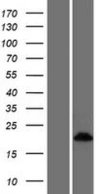 Western Blot: CRIP3 Overexpression Lysate [NBP2-04522]