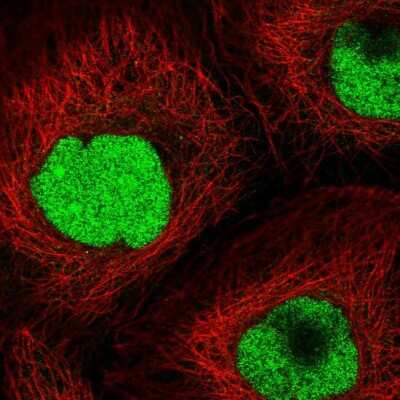 Immunocytochemistry/ Immunofluorescence: CRIPT Antibody [NBP2-58357]