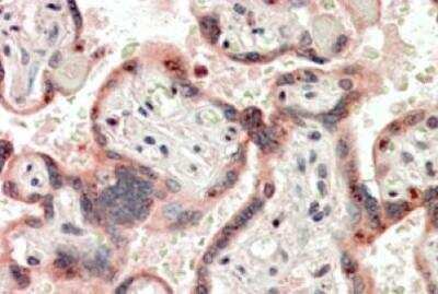 Immunohistochemistry-Paraffin: CRIPTO Antibody [NBP1-68841]