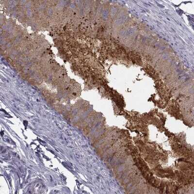 Immunohistochemistry-Paraffin: CRISP-1 Antibody [NBP1-89226]