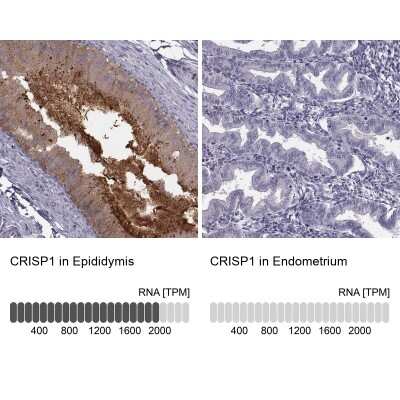 Immunohistochemistry-Paraffin: CRISP-1 Antibody [NBP1-89226]