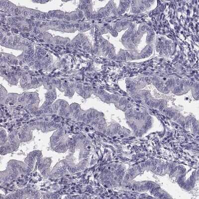 Immunohistochemistry-Paraffin: CRISP-1 Antibody [NBP1-89226]