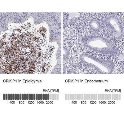 Immunohistochemistry-Paraffin: CRISP-1 Antibody [NBP2-62601]