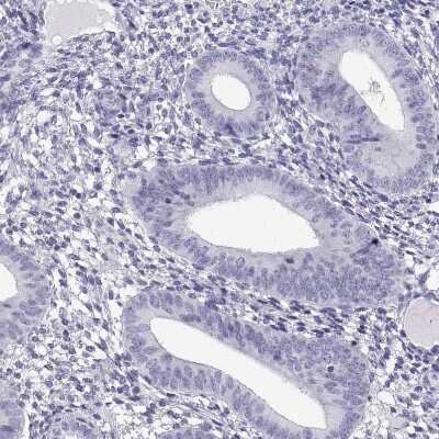Immunohistochemistry-Paraffin: CRISP-1 Antibody [NBP2-62601]