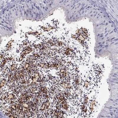 Immunohistochemistry-Paraffin: CRISP-1 Antibody [NBP2-62601]