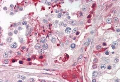 Immunohistochemistry-Paraffin: CRISP-2 Antibody [NBP1-52012]