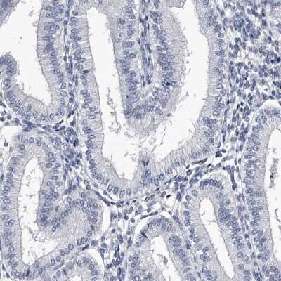 Immunohistochemistry-Paraffin: CRISP-2 Antibody [NBP1-85452]