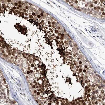 Immunohistochemistry-Paraffin: CRISP-2 Antibody [NBP1-85452]