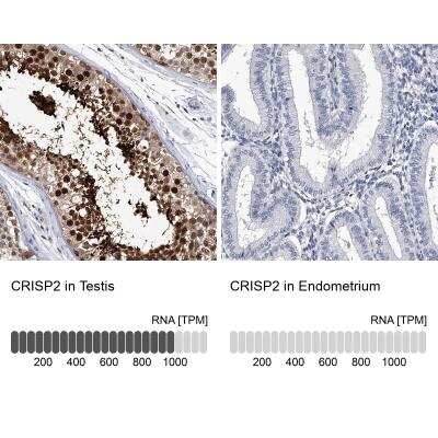 Immunohistochemistry-Paraffin: CRISP-2 Antibody [NBP1-85452]