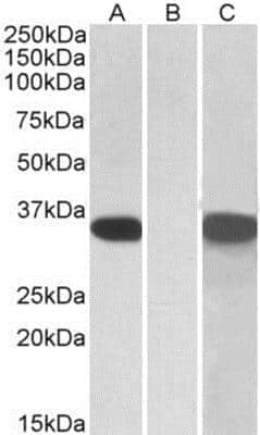 Western Blot: CRISP-2 Antibody [NBP1-52012]