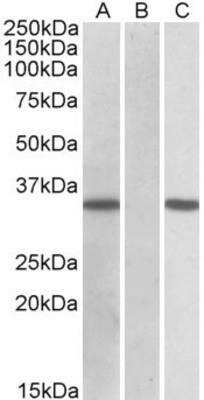 Western Blot: CRISP-2 Antibody [NBP1-52013]