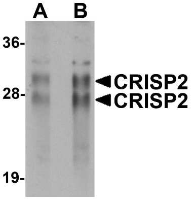 Western Blot: CRISP-2 AntibodyBSA Free [NBP1-76277]