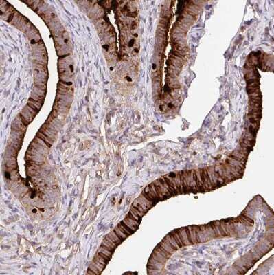 Immunohistochemistry-Paraffin: CRISP-3 Antibody [NBP2-33714]