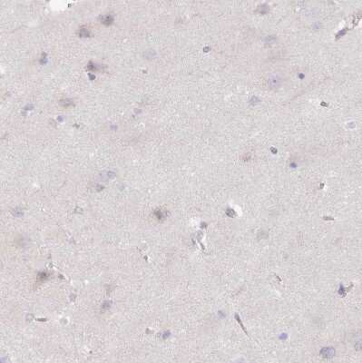 Immunohistochemistry-Paraffin: CRISP-3 Antibody [NBP2-33714]