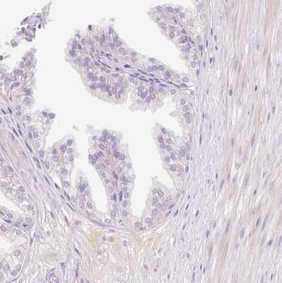 Immunohistochemistry-Paraffin: CRISP-3 Antibody [NBP2-33714]