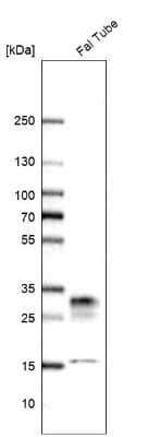 Western Blot: CRISP-3 Antibody [NBP2-33714]