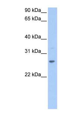 Western Blot: CRISP-1 Antibody [NBP1-79533]