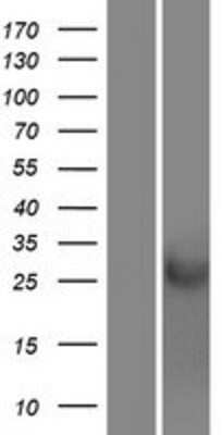 Western Blot: CRISP-1 Overexpression Lysate [NBP2-08231]