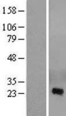 Western Blot: CRISP-2 Overexpression Lysate [NBL1-09480]