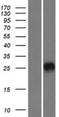 Western Blot: CRISP-3 Overexpression Lysate [NBL1-09481]