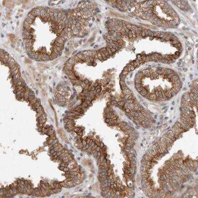 Immunohistochemistry-Paraffin: CRISPLD1 Antibody [NBP1-84413]