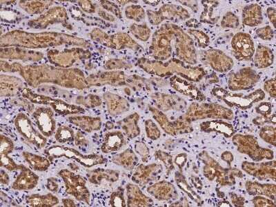Immunohistochemistry-Paraffin: CRISPLD1 Antibody [NBP2-97241]