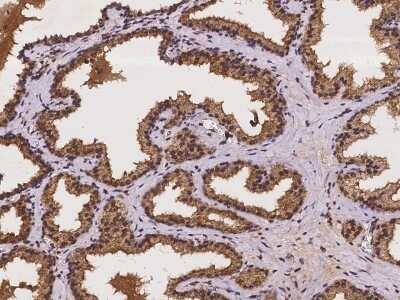 Immunohistochemistry-Paraffin: CRISPLD1 Antibody [NBP2-97241]