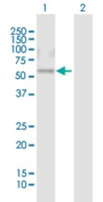 Western Blot: CRISPLD1 Antibody [H00083690-B01P]