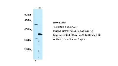 Western Blot: CRISPLD1 Antibody [NBP2-84725]