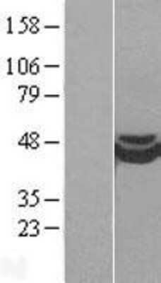 Western Blot: CRISPLD1 Overexpression Lysate [NBP2-04400]