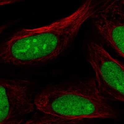 Immunocytochemistry/ Immunofluorescence: CRISPLD2 Antibody [NBP2-68613]