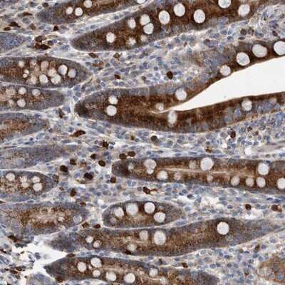 Immunohistochemistry-Paraffin: CRISPLD2 Antibody [NBP1-85143]