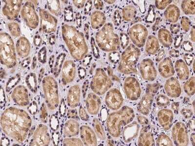 Immunohistochemistry-Paraffin: CRISPLD2 Antibody [NBP2-97242]