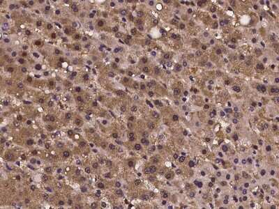 Immunohistochemistry-Paraffin: CRISPLD2 Antibody [NBP2-97242]