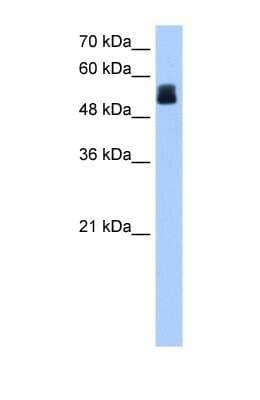 Western Blot: CRISPLD2 Antibody [NBP1-69620]