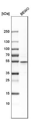 Western Blot: CRISPLD2 Antibody [NBP1-85143]