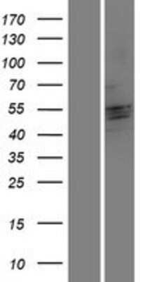 Western Blot: CRISPLD2 Overexpression Lysate [NBP2-06117]