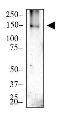 Western Blot: CRISPR-Cas9 Antibody (6G12)C-terminusAzide and BSA Free [NBP2-80680]