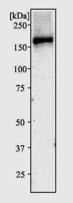 Western Blot: CRISPR-Cas9 Antibody Pack [NBP2-52986]