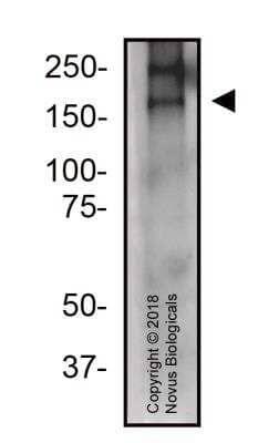 Western Blot: CRISPR-Cas9 AntibodyBSA Free [NBP2-66379]