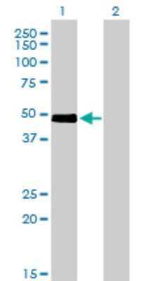 Western Blot: CRLF1 Antibody (4F4) [H00009244-M01]