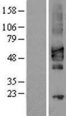 Western Blot: TSLPR/CRLF2 Overexpression Lysate [NBL1-09485]