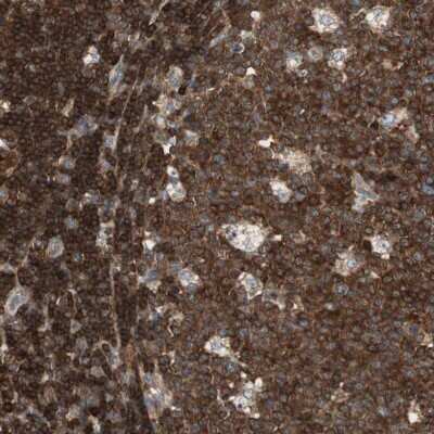Immunohistochemistry-Paraffin: CRLF3 Antibody [NBP1-84382]