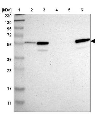 Western Blot: CRLF3 Antibody [NBP1-84382]
